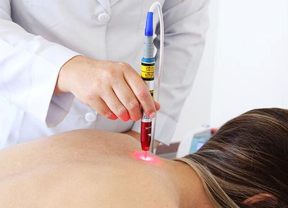 Laser Acupuncture